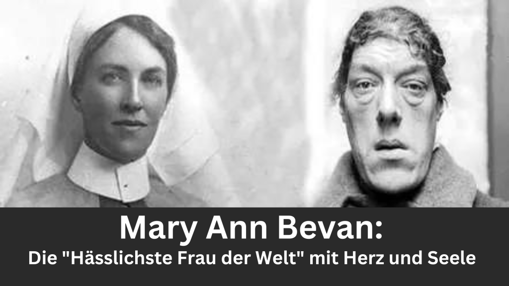 Mary Ann Bevan: Die "Hässlichste Frau der Welt" mit Herz und Seele