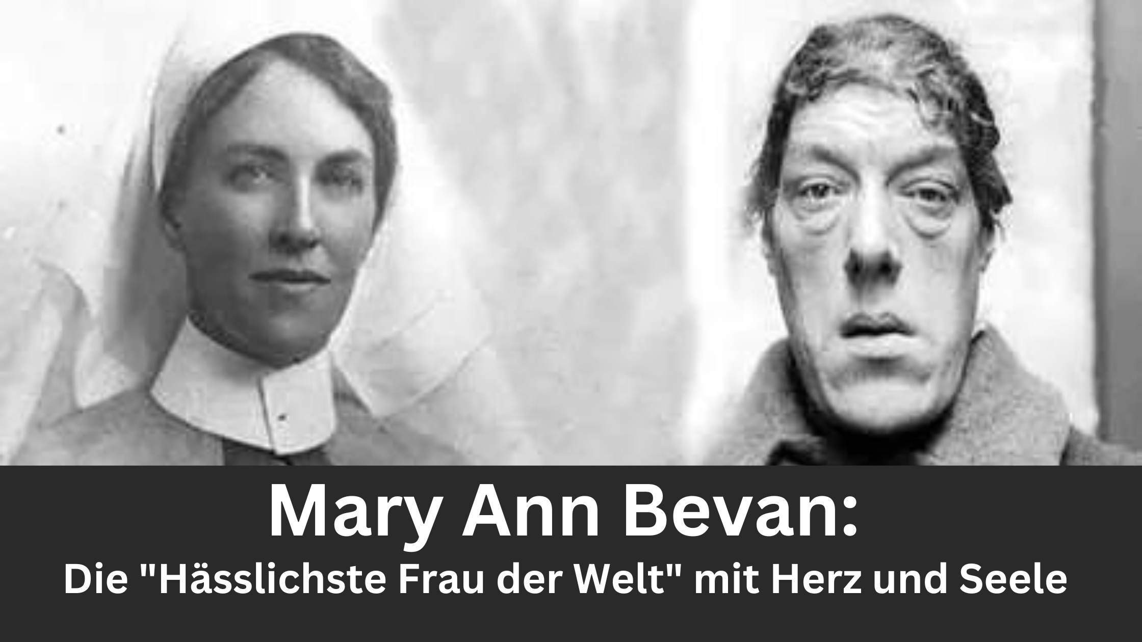 Mary Ann Bevan: Die „Hässlichste Frau der Welt“ mit Herz und Seele